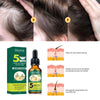 5 Days Ginger Hair Care Essential Oil Hair Growth Natural Solution Anti Hair Fall Oil Treatment Serum Essence Hair Care 30ml