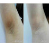 Ultra Brightening Spotless Essence Oil Skin Care Dark Spots Remove Ance Burn Strentch Marks Scar Removal Brightening US Stock - CyberMarkt