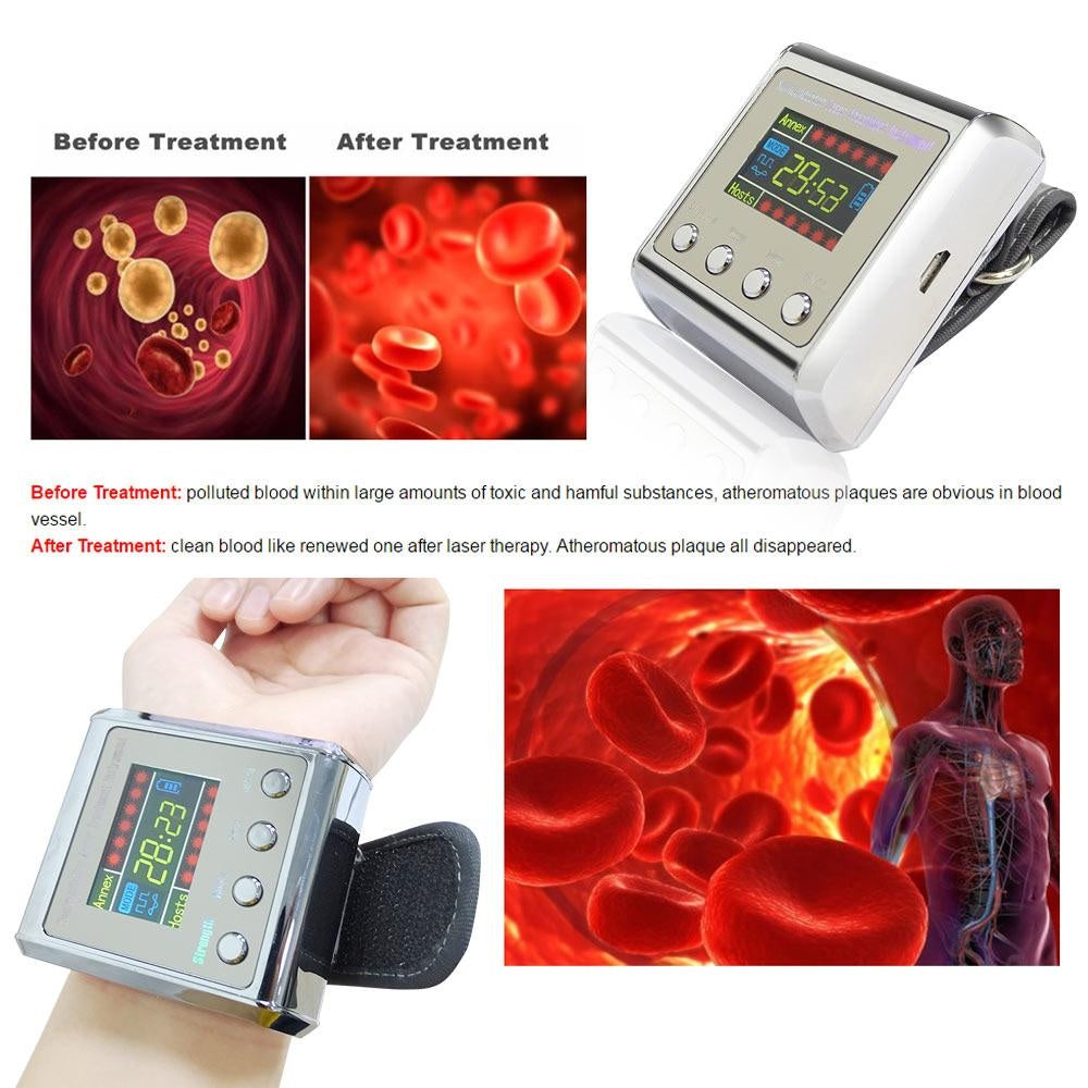 650nm Laser Therapy Wrist Low Frequency Diabetes Hypertension Cholesterol Treatment Diode LLLT Watch Laser Therapy Machine