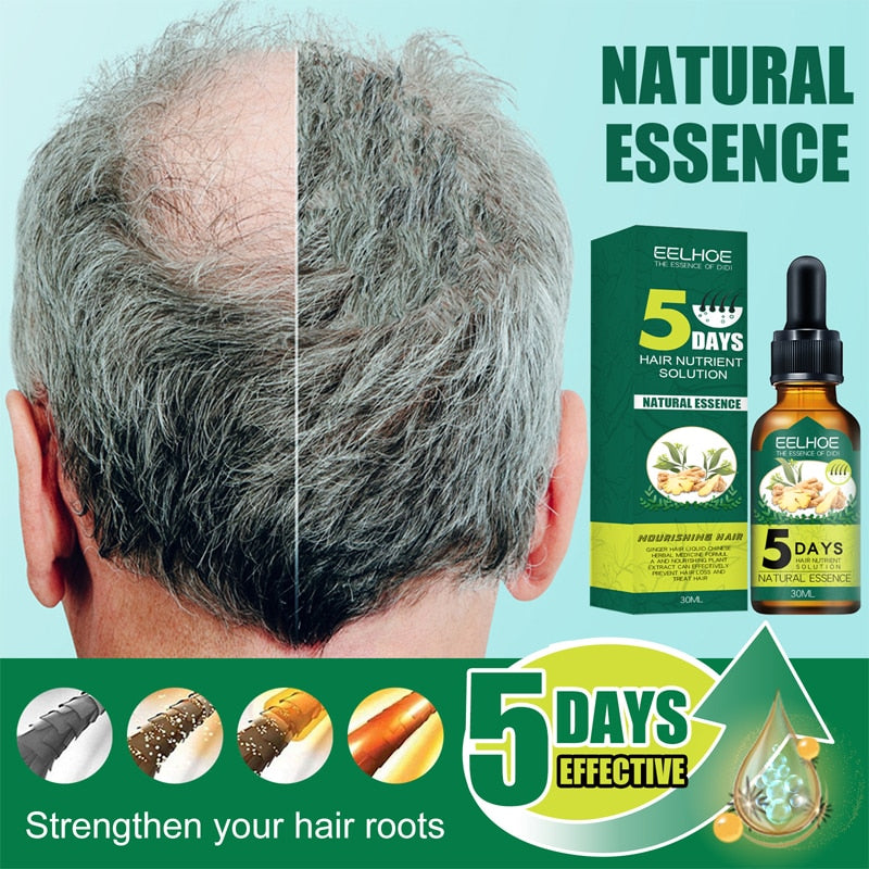 5 Days Ginger Hair Care Essential Oil Hair Growth Natural Solution Anti Hair Fall Oil Treatment Serum Essence Hair Care 30ml