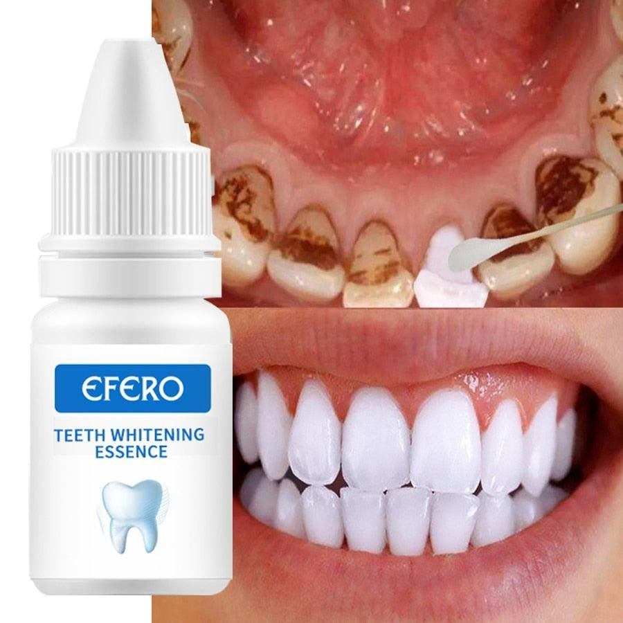 EFERO Teeth Whitening Essence Powder Clean Oral Hygiene Whiten Teeth Remove Plaque Stains Fresh Breath Oral Hygiene Dental Tools